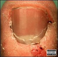 See Skrape's album -  songs & lyrics.